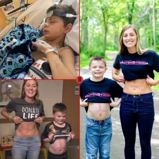 A Life-Saving Gift: Nurse Donates Part of Her Liver to Save a Patient in Critical Need