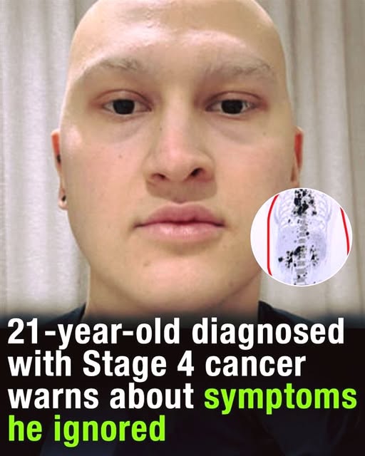 21-year-old opens up about his cancer diagnosis — and the early warning signs he wishes he hadn’t ignored 💔