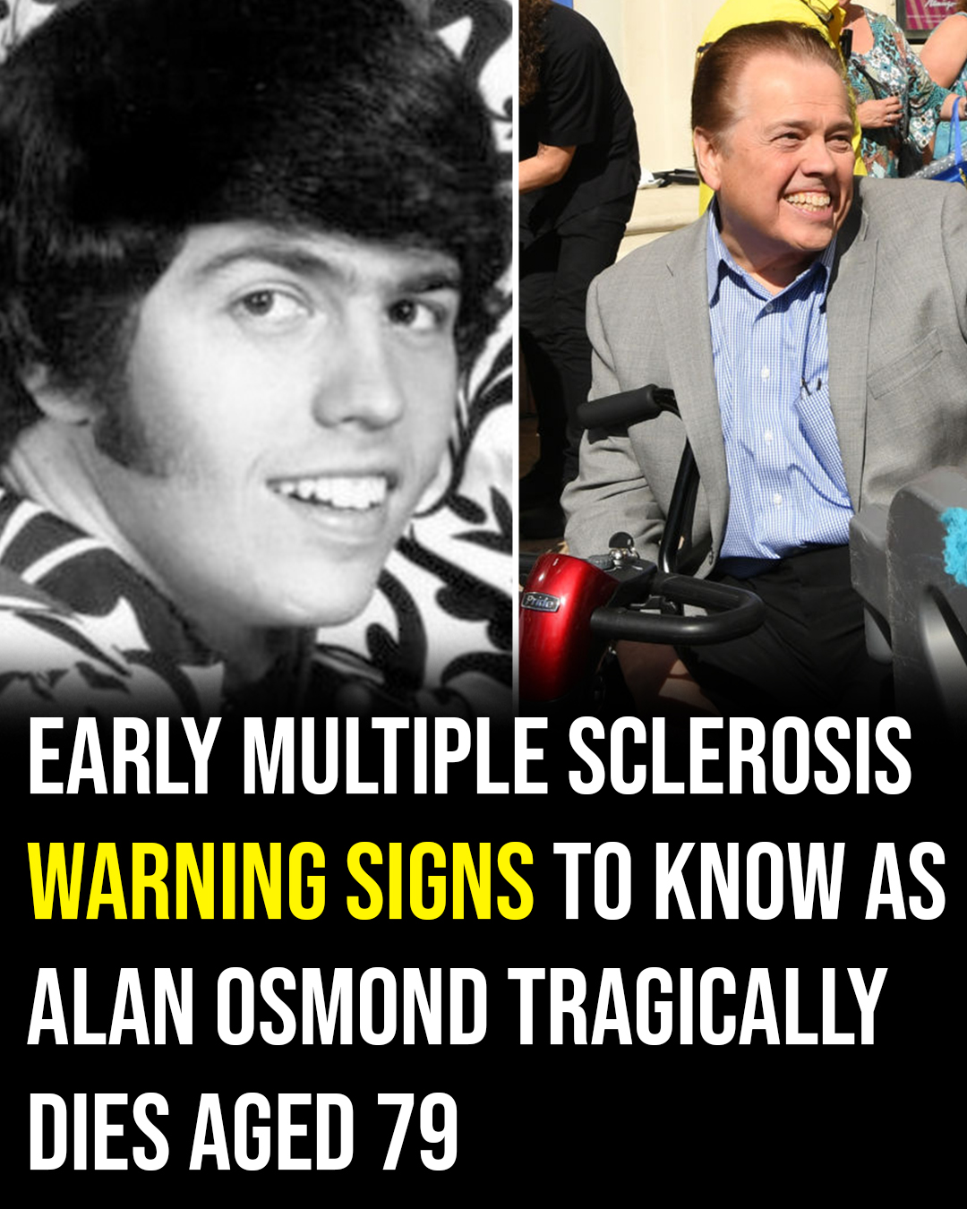 Early warning signs of multiple sclerosis to be aware of, following news that Alan Osmond has died at the age of 79.