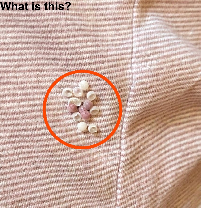 I found these tiny little balls in my bed and almost panicked—here’s what they actually were. See more 👇