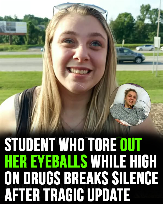 Student who suffered a severe self-inflicted eye injury while under the influence has been fired from her job.
