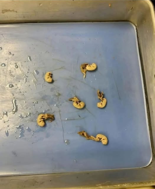 “Seeds in Your Snack?” What You Should Know About Unexpected Things That Can Show Up in Everyday Foods