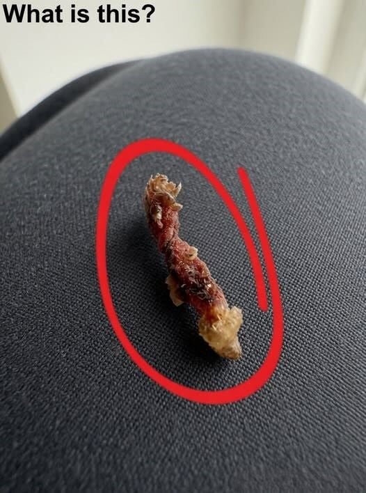 I woke up in the middle of the night feeling like something was biting my skin.