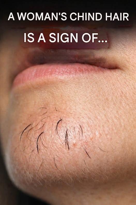 What Chin Hair in Women Really Says About Hormones