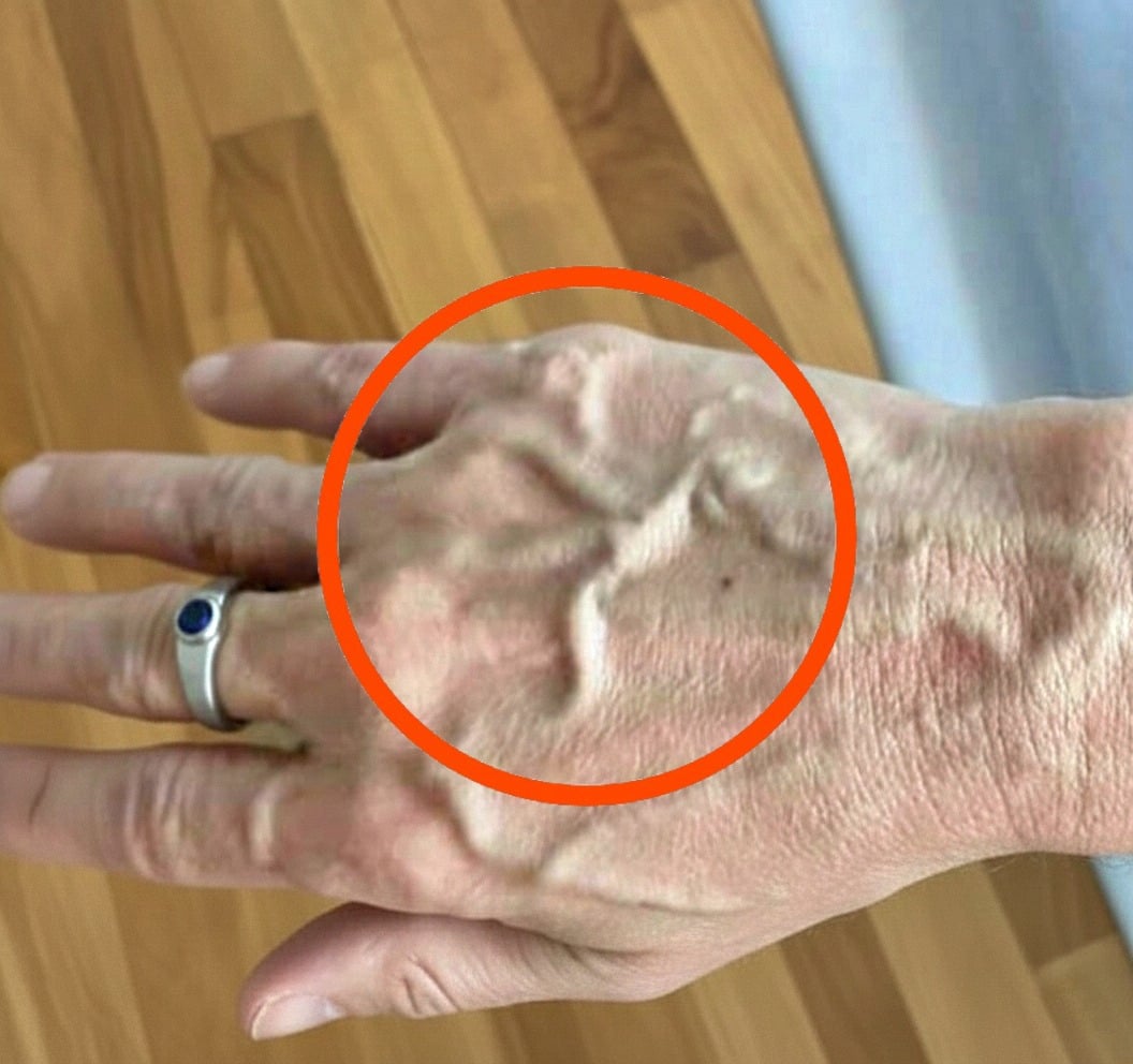 If your veins are clearly visible, it often means you are… see more below 👇
