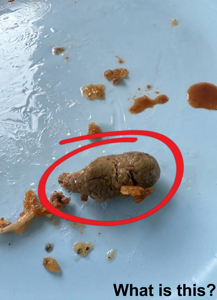 I found this inside my fried chicken—it was in the breast.
