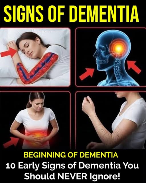 10 Early Warning Signs of Dementia You Should Never Overlook 👇🏻