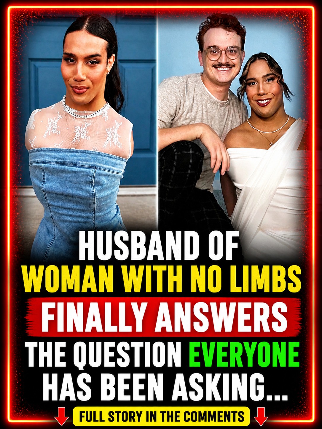 Woman With No Limbs’ Husband Finally Responds To The Question Everyone Keeps Asking