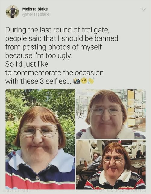 A woman who was once bullied for her appearance began taking a selfie every day for a year, turning hurtful comments into a powerful message that ended up inspiring thousands of people.