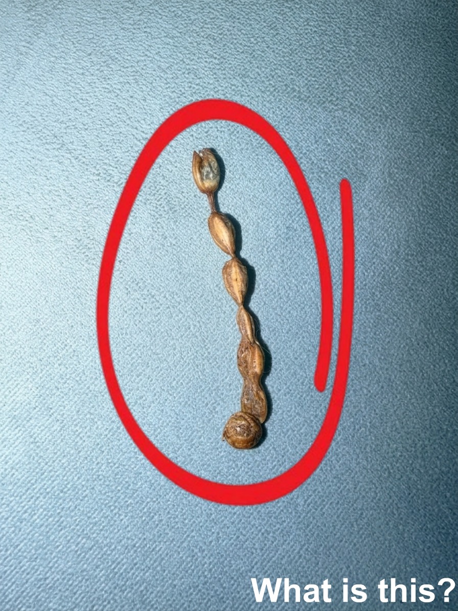 I found this strange thing on my couch and it honestly looks a little unsettling. I’ve been staring at it forever trying to figure out what it could be, but I still have no clue. Has anyone seen anything like this before?