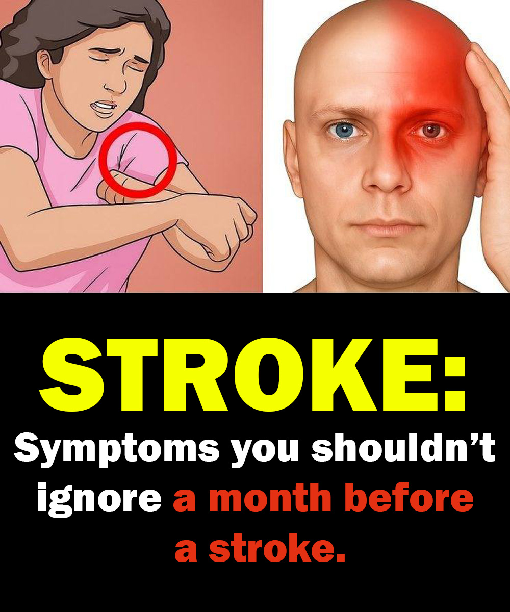 Up to a month before a stroke, the body can sometimes give early warning signs — and they may look different in men and women. Here are symptoms you shouldn’t ignore.