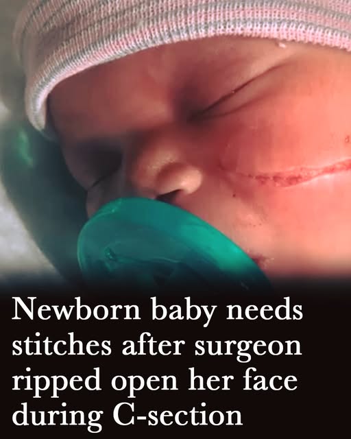 “Newborn Undergoes Urgent Care Following Shocking Delivery Room Mishap”