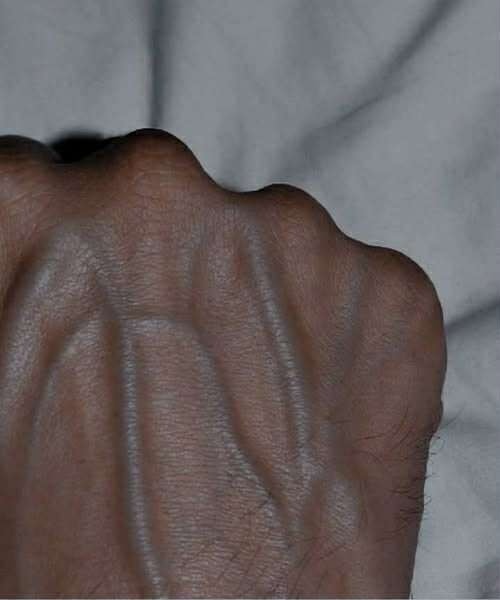 “If your veins are visible, it may mean your body has low body fat, strong circulation, or naturally prominent veins.”